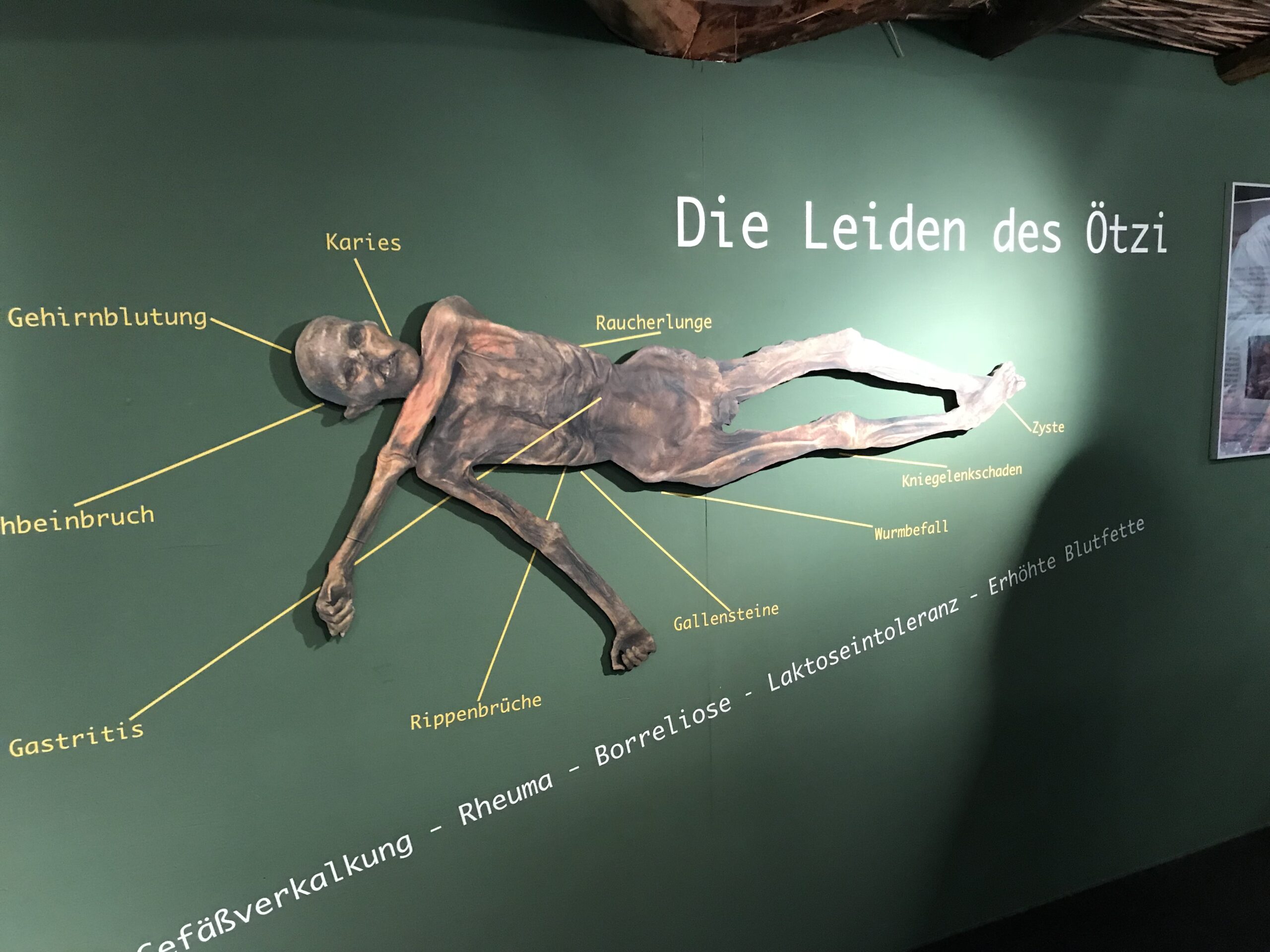 Ekspozycja o chorobach i urazach Ötziego Ekspozycja Die Leiden des Ötzi z rekonstrukcją mumii i opisami chorób oraz urazów człowieka lodu.